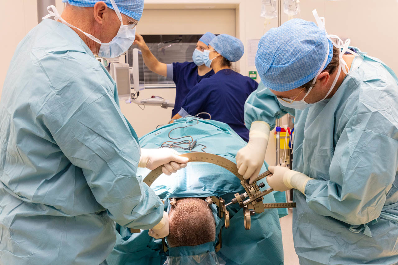 ACE stereo EEG epilepsie chirurgie 21
