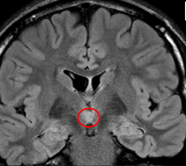 HH MRI