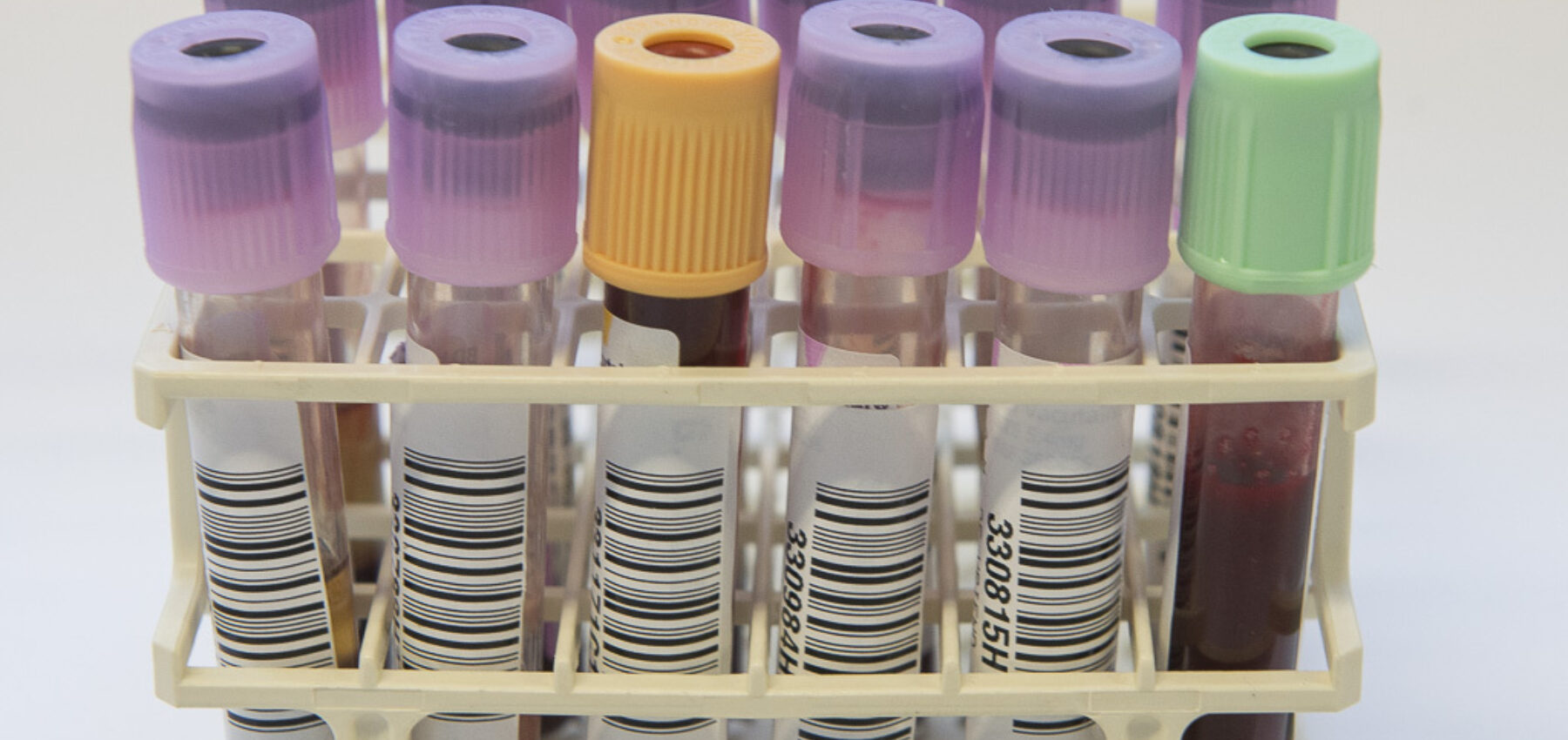 Schakel reportage laboratorium 1sa 08