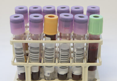 Schakel reportage laboratorium 1sa 08